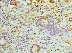 Immunohistochemistry of paraffin-embedded human kidney tissue using ATP6V1B1 Antibody at dilution of 1:100