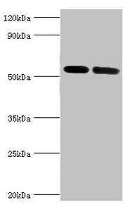 Western blot | All lanes: V-type proton ATPase subunit B, kidney isoform antibody at 7μg/ml | Lane 1: Mouse kidney tissue | Lane 2: 293T whole cell lysate | Secondary | Goat polyclonal to rabbit IgG at 1/10000 dilution | Predicted band size: 57 kDa | Observed band size: 57 kDa