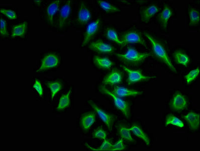 Immunofluorescence staining of A549 cells with the antibody at 1:133, counter-stained with DAPI. The cells were fixed in 4% formaldehyde, permeabilized using 0.2% Triton X-100 and blocked in 10% normal Goat Serum. The cells were then incubated with the antibody overnight at 4°C. The secondary antibody was Alexa Fluor 488-congugated AffiniPure Goat Anti-Rabbit IgG(H+L).