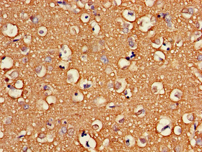 Immunohistochemistry of paraffin-embedded human brain tissue using ATP6V1G2 Antibody at dilution of 1:100