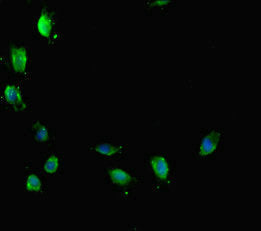 Immunofluorescent analysis of Hela cells using ATRX Antibody at dilution of 1:100 and Alexa Fluor 488-congugated AffiniPure Goat Anti-Rabbit IgG(H+L)
