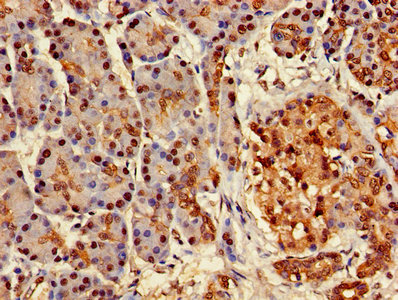 Immunohistochemistry of paraffin-embedded human pancreatic tissue using ATXN3 Antibody at dilution of 1:100