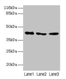 Western blot  | All lanes: ATXN3 antibody at 2µg/ml  | Lane 1: 293T whole cell lysate  | Lane 2: Mouse brain tissue  | Lane 3: MCF-7 whole cell lysate  | Secondary  | Goat polyclonal to rabbit IgG at 1/10000 dilution  | Predicted band size: 42, 36, 40, 21 kDa  | Observed band size: 42 kDa