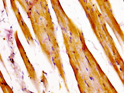 IHC image of ATXN7 Antibody diluted at 1:400 and staining in paraffin-embedded human skeletal muscle tissue performed on a Leica BondTM system. After dewaxing and hydration, antigen retrieval was mediated by high pressure in a citrate buffer (pH 6.0). Section was blocked with 10% normal goat serum 30min at RT. Then primary antibody (1% BSA) was incubated at 4°C overnight. The primary is detected by a biotinylated secondary antibody and visualized using an HRP conjugated SP system.
