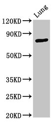 Western Blot | Positive WB detected in: Rat lung tissue | All lanes: ATXN7 antibody at 3.3μg/ml | Secondary | Goat polyclonal to rabbit IgG at 1/50000 dilution | Predicted band size: 96, 102, 80 kDa | Observed band size: 80 kDa