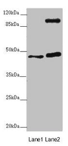 Western blot  | All lanes: AURKA antibody at 2μg/ml  | Lane 1: NIH/3T3 whole cell lysate  | Lane 2: HT29 whole cell lysate  | Secondary  | Goat polyclonal to rabbit IgG at 1/10000 dilution  | Predicted band size: 46 kDa  | Observed band size: 46, 110 kDa