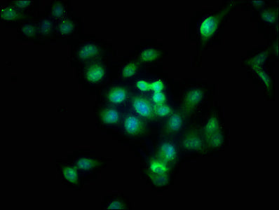 Immunofluorescence staining of Hela cells with the antibody at 1:166, counter-stained with DAPI. The cells were fixed in 4% formaldehyde, permeabilized using 0.2% Triton X-100 and blocked in 10% normal Goat Serum. The cells were then incubated with the antibody overnight at 4°C. The secondary antibody was Alexa Fluor 488-congugated AffiniPure Goat Anti-Rabbit IgG(H+L).
