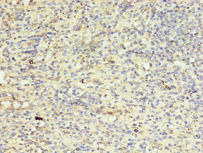 Immunohistochemistry of paraffin-embedded human spleen tissue using AURKB Antibody at dilution of 1:100