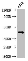 Western Blot  | Positive WB detected in: A375 whole cell lysate  | All lanes: AURKC antibody at 3.2µg/ml  | Secondary  | Goat polyclonal to rabbit IgG at 1/50000 dilution  | Predicted band size: 36, 33, 34 kDa  | Observed band size: 45 kDa