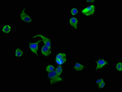 Immunofluorescence staining of MCF-7 cells with AVPR2 Antibody at 1:200, counter-stained with DAPI. The cells were fixed in 4% formaldehyde, permeabilized using 0.2% Triton X-100 and blocked in 10% normal Goat Serum. The cells were then incubated with the antibody overnight at 4°C. The secondary antibody was Alexa Fluor 488-congugated AffiniPure Goat Anti-Rabbit IgG(H+L).