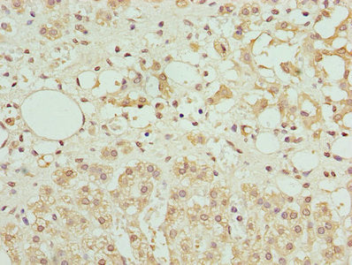 Immunohistochemistry of paraffin-embedded human adrenal gland tissue using AZIN1 Antibody at dilution of 1:100