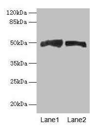 Western blot  | All lanes: AZIN1 antibody at 4µg/ml  | Lane 1: Mouse liver tissue  | Lane 2: PC-3 whole cell lysate  | Secondary  | Goat polyclonal to rabbit IgG at 1/10000 dilution  | Predicted band size: 50 kDa  | Observed band size: 50 kDa
