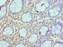 Immunohistochemistry of paraffin-embedded human colon tissue using AZU1 Antibody at dilution of 1:100