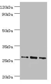 Western blot | All lanes: Azurocidin antibody at 1μg/ml | Lane 1: 293T whole cell lysate | Lane 2: Mouse spleen tissue | Lane 3: Mouse thymus tissue | Secondary | Goat polyclonal to rabbit IgG at 1/10000 dilution | Predicted band size: 27 kDa | Observed band size: 27 kDa