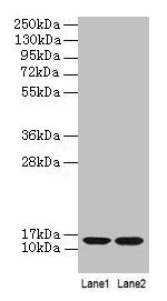Western blot  | All lanes: B2M antibody at 2µg/ml  | Lane 1: A431 whole cell lysate  | Lane 2: Mouse lung tissue  | Secondary  | Goat polyclonal to rabbit IgG at 1/10000 dilution  | Predicted band size: 14 kDa  | Observed band size: 14 kDaRabbit anti-Human B2M Polyclonal Antibody