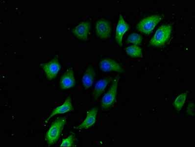 Immunofluorescence staining of A549 cells with B3GALT2 Antibody at 1:133, counter-stained with DAPI. The cells were fixed in 4% formaldehyde, permeabilized using 0.2% Triton X-100 and blocked in 10% normal Goat Serum. The cells were then incubated with the antibody overnight at 4°C. The secondary antibody was Alexa Fluor 488-congugated AffiniPure Goat Anti-Rabbit IgG(H+L).