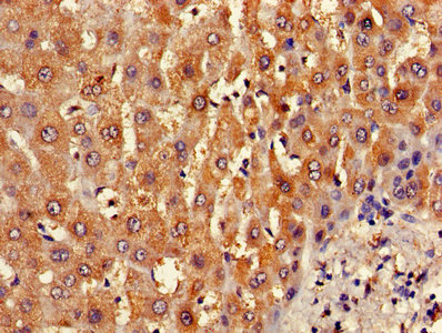 Immunohistochemistry of paraffin-embedded human liver tissue using the antibody at dilution of 1:100