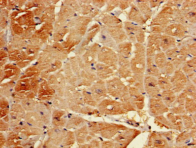 Immunohistochemistry of paraffin-embedded human heart tissue using B3GALT2 Antibody at dilution of 1:100