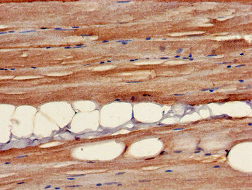 Immunohistochemistry of paraffin-embedded human skeletal muscle tissue using B3GALT4 Antibody at dilution of 1:100