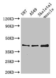 Western Blot  | Positive WB detected in: U87 whole cell lysate, A549 whole cell lysate, Mouse skeletal muscle tissue  | All lanes: B3GALT4 antibody at 3µg/ml  | Secondary  | Goat polyclonal to rabbit IgG at 1/50000 dilution  | Predicted band size: 42 kDa  | Observed band size: 42 kDa