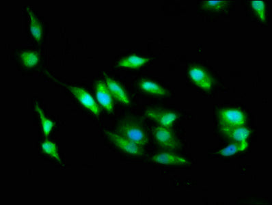 Immunofluorescence staining of Hela cells with STK24 Antibody at 1:100, counter-stained with DAPI. The cells were fixed in 4% formaldehyde, permeabilized using 0.2% Triton X-100 and blocked in 10% normal Goat Serum. The cells were then incubated with the antibody overnight at 4°C. The secondary antibody was Alexa Fluor 488-congugated AffiniPure Goat Anti-Rabbit IgG(H+L).Rabbit anti-Human STK24 Polyclonal Antibody