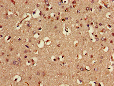 Immunohistochemistry of paraffin-embedded human brain tissue using STK24 Antibody at dilution of 1:100Rabbit anti-Human STK24 Polyclonal Antibody