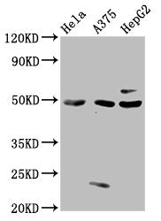 Western Blot  | Positive WB detected in: Hela whole cell lysate, A375 whole cell lysate, HepG2 whole cell lysate  | All lanes: STK24 antibody at 3µg/ml  | Secondary  | Goat polyclonal to rabbit IgG at 1/50000 dilution  | Predicted band size: 50, 48 kDa  | Observed band size: 50 kDaRabbit anti-Human STK24 Polyclonal Antibody