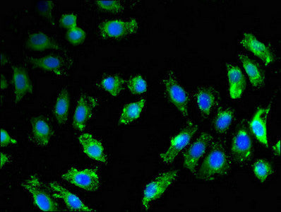 Immunofluorescent analysis of A549 cells using BACE1 Antibody at dilution of 1:100 and Alexa Fluor 488-congugated AffiniPure Goat Anti-Rabbit IgG(H+L)