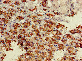Immunohistochemistry of paraffin-embedded human adrenal gland tissue using the antibody at dilution of 1:100