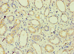 Immunohistochemistry of paraffin-embedded human kidney tissue using BAG2 Antibody at dilution of 1:100