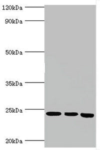 Western blot | All lanes: BAG family molecular chaperone regulator 2 antibody at 6μg/ml | Lane 1: Jurkat whole cell lysate | Lane 2: Hela whole cell lysate | Lane 3: HepG2 whole cell lysate | Secondary | Goat polyclonal to rabbit IgG at 1/10000 dilution | Predicted band size: 24, 21 kDa | Observed band size: 24 kDa