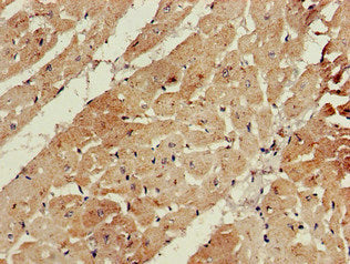 Immunohistochemistry of paraffin-embedded human heart tissue using the antibody at dilution of 1:100