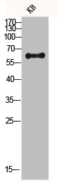 Western blot analysis of KB lysis using FRS2 antibody.Rabbit anti-Human FRS2 Polyclonal Antibody