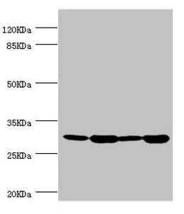 Western blot  | All lanes: BCAP29 antibody at 2.93µg/ml  | Lane 1: Raji whole cell lysate  | Lane 2: Colo320 whole cell lysate  | Lane 3: Rat gonad tissue  | Lane 4: THP-1 whole cell lysate  | Secondary  | Goat polyclonal to rabbit IgG at 1/10000 dilution  | Predicted band size: 29, 41 kDa  | Observed band size: 29 kDa