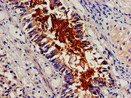 Immunohistochemistry of paraffin-embedded human lung tissue using BCAR1 Antibody at dilution of 1:100