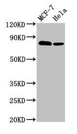 Western Blot  | Positive WB detected in: MCF-7 whole cell lysate, Hela whole cell lysate  | All lanes: BCAR1 antibody at 3.4µg/ml  | Secondary  | Goat polyclonal to rabbit IgG at 1/50000 dilution  | Predicted band size: 94, 96, 78, 98 kDa  | Observed band size: 78 kDa