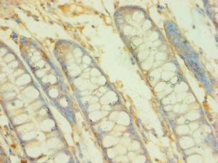 Immunohistochemistry of paraffin-embedded human colon tissue using BCAT2 Antibody at dilution of 1:100