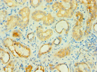 Immunohistochemistry of paraffin-embedded human kidney tissue using BCAT2 Antibody at dilution of 1:100