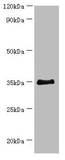 Western blot  | All lanes: BCAT2 antibody at 14µg/ml + 293T whole cell lysate  | Secondary  | Goat polyclonal to rabbit IgG at 1/10000 dilution  | Predicted band size: 45, 34 kDa  | Observed band size: 34 kDa