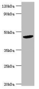 Western blot  | All lanes: BCKDK antibody at 5µg/ml + Hela whole cell lysate  | Secondary  | Goat polyclonal to rabbit IgG at 1/10000 dilution  | Predicted band size: 47, 38, 42 kDa  | Observed band size: 47 kDa