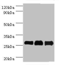Western blot | All lanes: B-cell lymphoma/leukemia 10 antibody at 9μg/ml | Lane 1: Mouse gonad tissue | Lane 2: MCF-7 whole cell lysate | Lane 3: NIH/3T3 whole cell lysate | Secondary | Goat polyclonal to rabbit IgG at 1/10000 dilution | Predicted band size: 26 kDa | Observed band size: 26 kDa