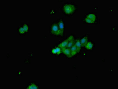 Immunofluorescent analysis of HepG2 cells using BCL2L11 Antibody at dilution of 1:100 and Alexa Fluor 488-congugated AffiniPure Goat Anti-Rabbit IgG(H+L)