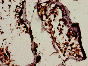 Immunohistochemistry analysis of human testis tissue using the antibody at dilution of 1:100