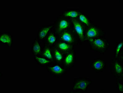 Immunofluorescence staining of A549 cells with BCL3 Antibody at 1:133, counter-stained with DAPI. The cells were fixed in 4% formaldehyde, permeabilized using 0.2% Triton X-100 and blocked in 10% normal Goat Serum. The cells were then incubated with the antibody overnight at 4°C. The secondary antibody was Alexa Fluor 488-congugated AffiniPure Goat Anti-Rabbit IgG(H+L).
