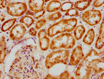 IHC image of BCL9 Antibody diluted at 1:200 and staining in paraffin-embedded human kidney tissue performed on a Leica BondTM system. After dewaxing and hydration, antigen retrieval was mediated by high pressure in a citrate buffer (pH 6.0). Section was blocked with 10% normal goat serum 30min at RT. Then primary antibody (1% BSA) was incubated at 4°C overnight. The primary is detected by a biotinylated secondary antibody and visualized using an HRP conjugated SP system.