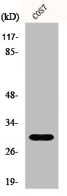 Western Blot analysis of COS7 cells using GCSm-γ Polyclonal AntibodyRabbit anti-Human GCLM Polyclonal Antibody