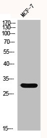 Western Blot analysis of MCF-7 cells using GCSm-γ Polyclonal AntibodyRabbit anti-Human GCLM Polyclonal Antibody