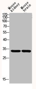 Western blot analysis of Mouse-kidney mouse-brain lysis using GCSm-γ antibody.Rabbit anti-Human GCLM Polyclonal Antibody