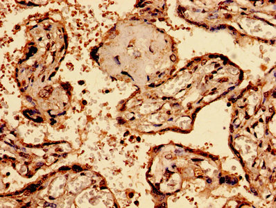 Immunohistochemistry analysis of human placenta tissue using BGN Antibody at dilution of 1:100