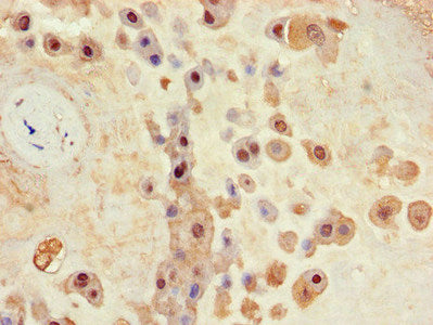 Immunohistochemistry of paraffin-embedded human placenta tissue using BHLHE40 Antibody at dilution of 1:100